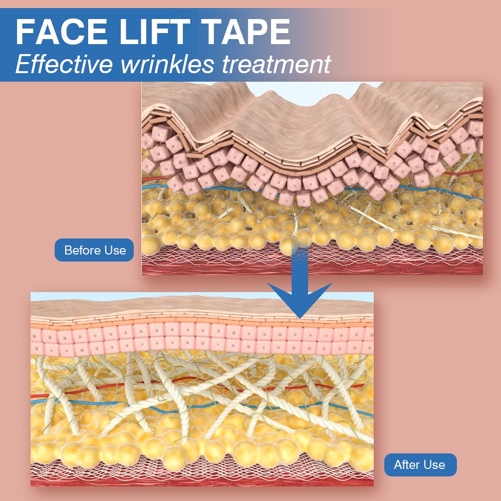 Anti-Wrinkle Tape Facial Myofascial Lift Tape 2.5CM x 5M,2 Rolls